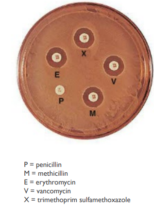 <p>(LC) You perform an antibiotic resistance test and observe these results. Does your patient have a MRSA infection?</p><ol><li><p>Yes</p></li><li><p>No</p></li><li><p>It is impossible to tell.</p></li></ol><p></p>
