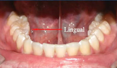 lingual surface for lower teeth