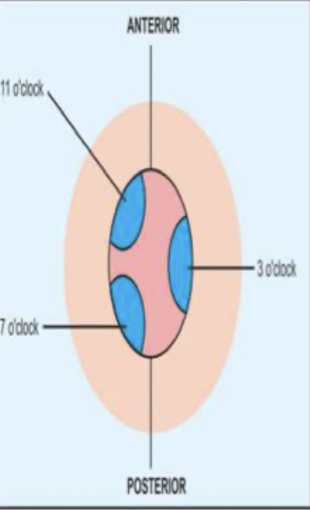<p>Anatomical location of the hemorrhoids can be described as</p>