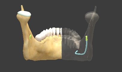 term image