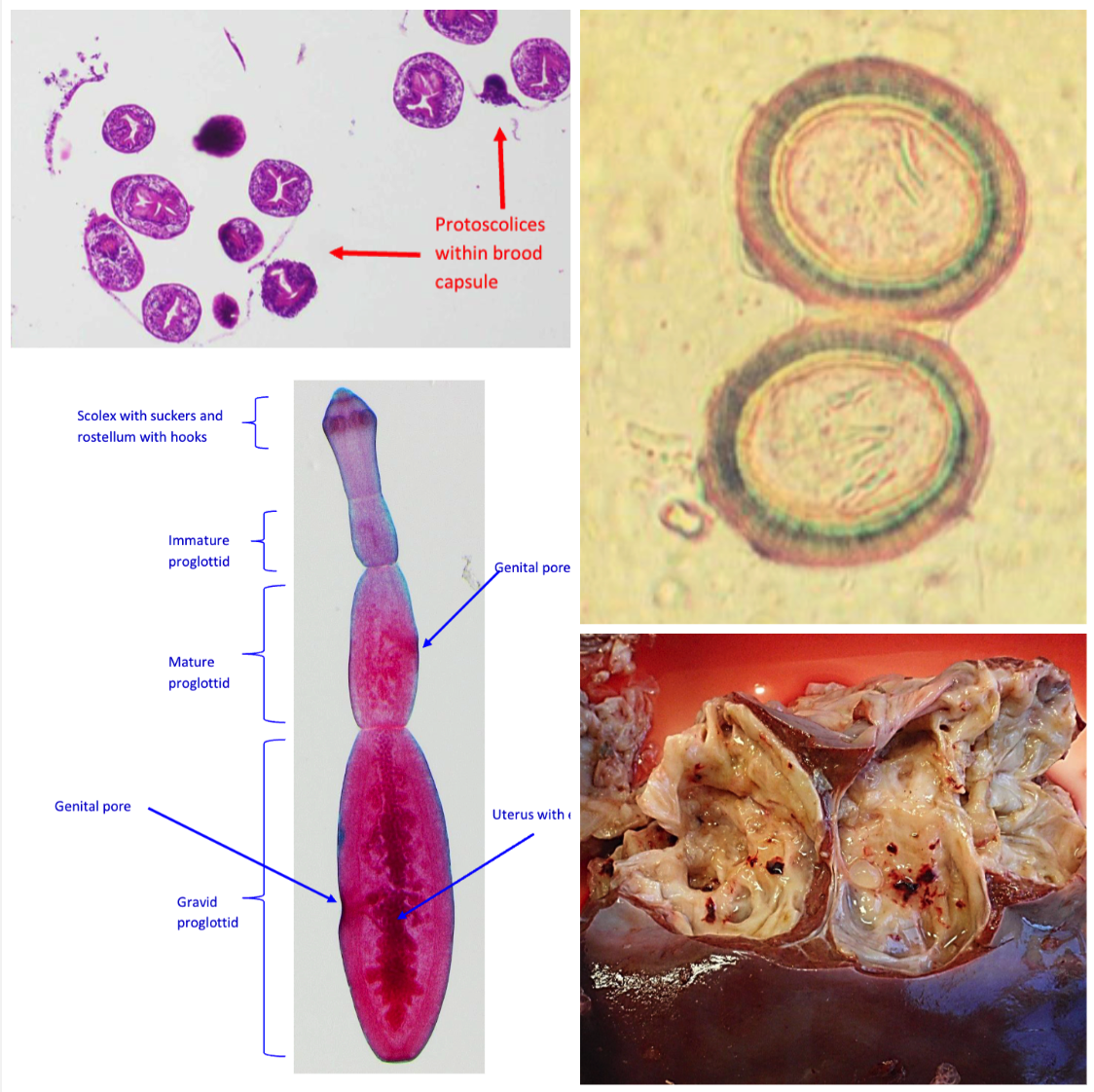 <p>LIVER &amp; LUNGS</p><ul><li><p>Ingestion of eggs shed by dogs (IH)</p></li><li><p>Hyatid cysts with brood capsule and invaginated/evaginated protoscolexes are pathogenic</p></li><li><p>Laminated and germinal layer</p></li><li><p>Egg is striated embryophore with hexacanth embryo within (oncosphere)</p></li><li><p>Adult with 3-4 proglottids, scolex with 2 rows of hooks and cause no clinical signs, not pathogenic</p></li><li><p>Develop in lung and livers of HUMANS</p></li></ul>