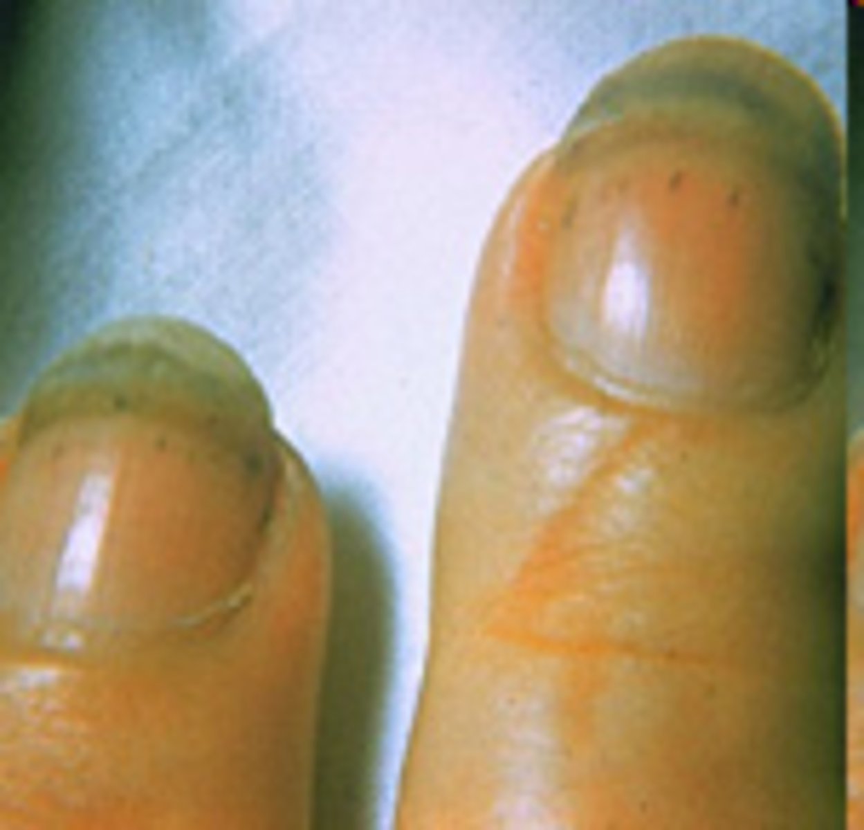 <p>Around the thumb, Between the fingers closest to the palm and under the nails</p>