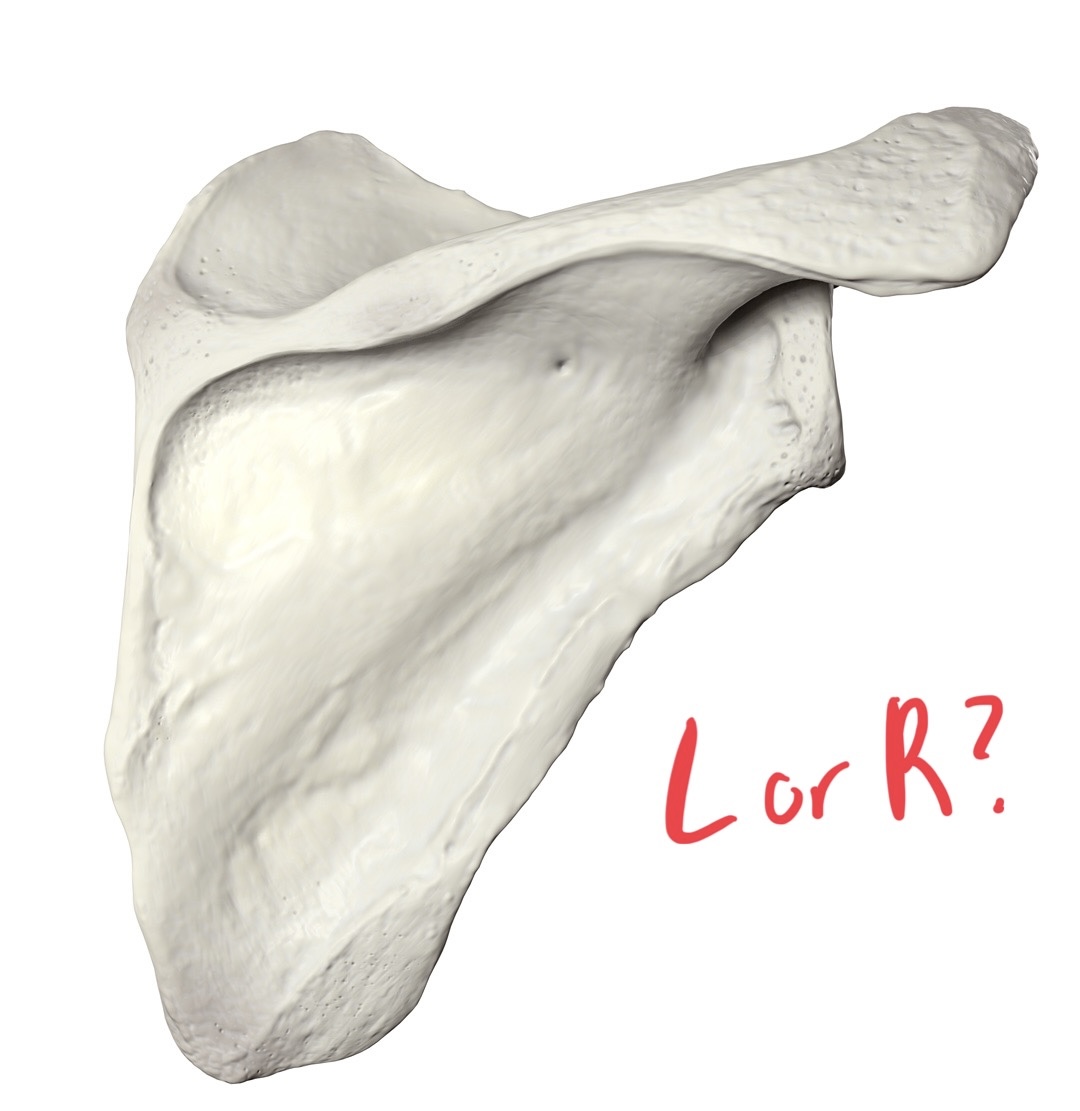 <p>Spine points at 2oclock</p>