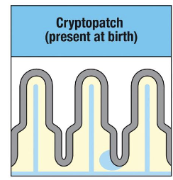 <p>(present at birth)</p><ul><li><p>small clusters of DCs and lymphoid tissue-inducer (LTi) cells</p></li></ul><p></p>
