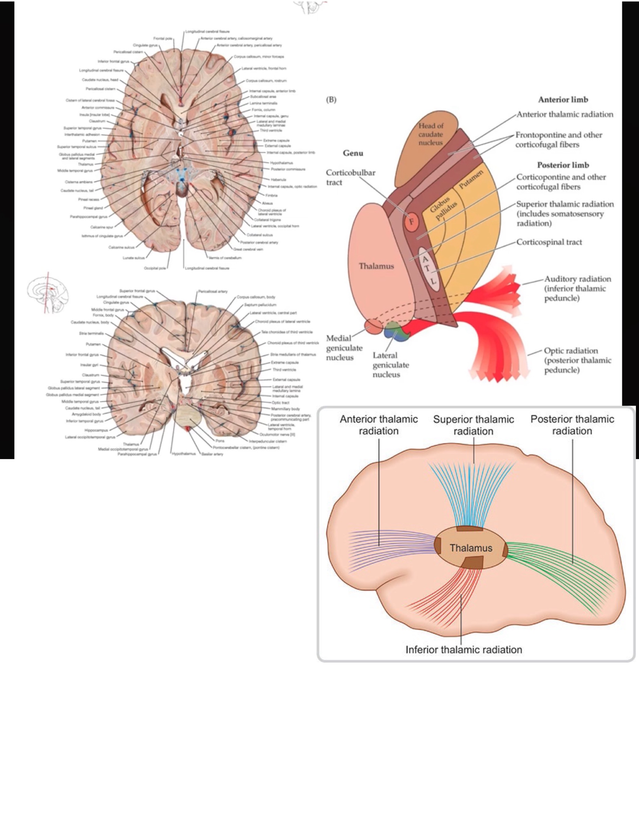 <ul><li><p>włókna wzgórzowo-korowe » tworzą&nbsp;promienistość&nbsp;wzgórza (thalamic radiation)</p><ul><li><p>konar przedni wzgórza (anterior thalamic peduncle) » łączy wzgórze z korą&nbsp;płata czołowego i częścią&nbsp;zakrętu obręczy </p></li><li><p>konar górny wzgórza (superior thalamic peduncle) » wzgórze z częścią&nbsp;tylną&nbsp;płata czołowego i płatem ciemieniowym</p></li><li><p>konar tylny wzgórza (posterior thalamic peduncle) » wzgó<span data-name="registered" data-type="emoji">®</span>ze z płatem skroniowym, potylicznym i tylną&nbsp;częścią płata ciemieniowego</p></li><li><p>konar dolny wzgórza (inferior thalamic peduncle) » część&nbsp;tzw. pętli konarowej (ansa peduncularis)</p></li></ul></li></ul>