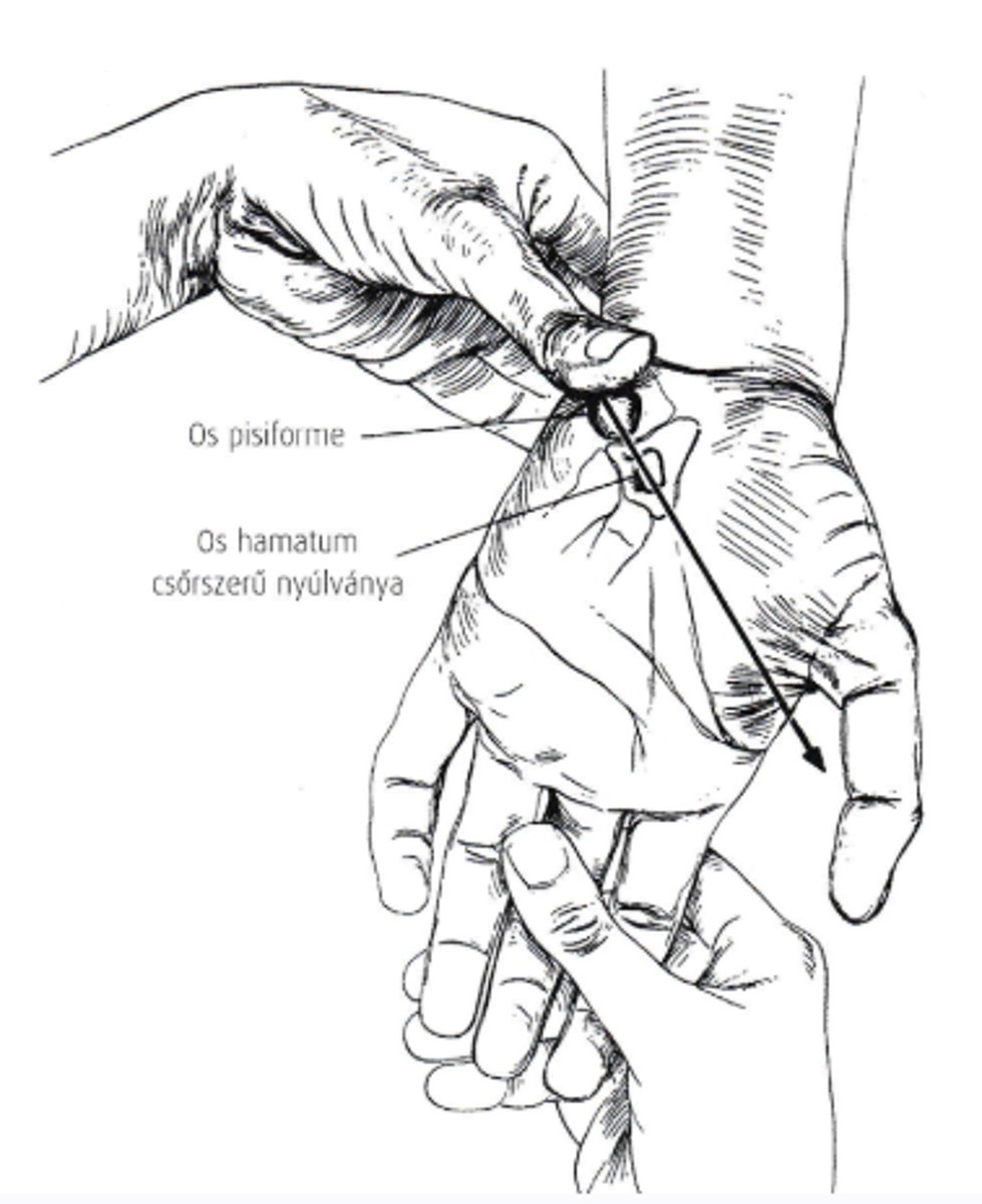 <p>- processus styloideus radii</p><p>- fossa tabatiere (os scaphoideum az alapja) > gyakran törik</p><p>{mn. fovea radialis}</p><p>- lister tuberculum (tub. Radii - III. MC vonalában, kissé radiál felé) > EPL fut itt</p><p>- os scaphoideum > proc. styl. radii-tól disztál felé</p><p>- os trapezium > scaphoideumtól disztál felé</p><p>- os lunatum > csak flexiókor; leggyakoribb diszlokáció, 2. leggyak. törés</p><p>- os capitatum > III. MC vonalában, neutrálban tap.</p><p>- processus styloideus ulnae > radialdeviatióban tap.</p><p>- os triquetrum > a proc. styl. Ulnae-tól dist., radiáldeviáció tap.</p><p>- os pisiforme > os triquetrumon</p><p>- os hamatum > pisiformétől diagonálisan (ld. kép)</p>