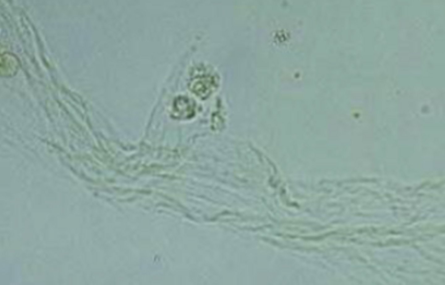 <p>- Look like folding ribbons</p><p>- Seen in equine urine</p>