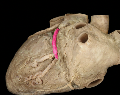 <p>circumflex artery</p>