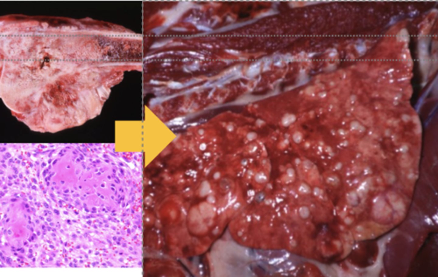 <p>What kind of tumor is this? (broad category)</p>