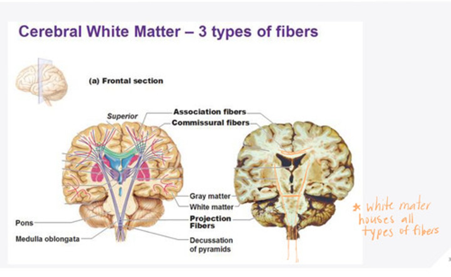 <p>What are the examples of corticopedal (afferent) projection fibers in the white matter of the brain?</p>