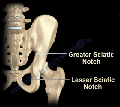 <p>Greater Sciatic Notch</p>