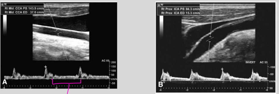 <p>what is this waveform showing?</p>