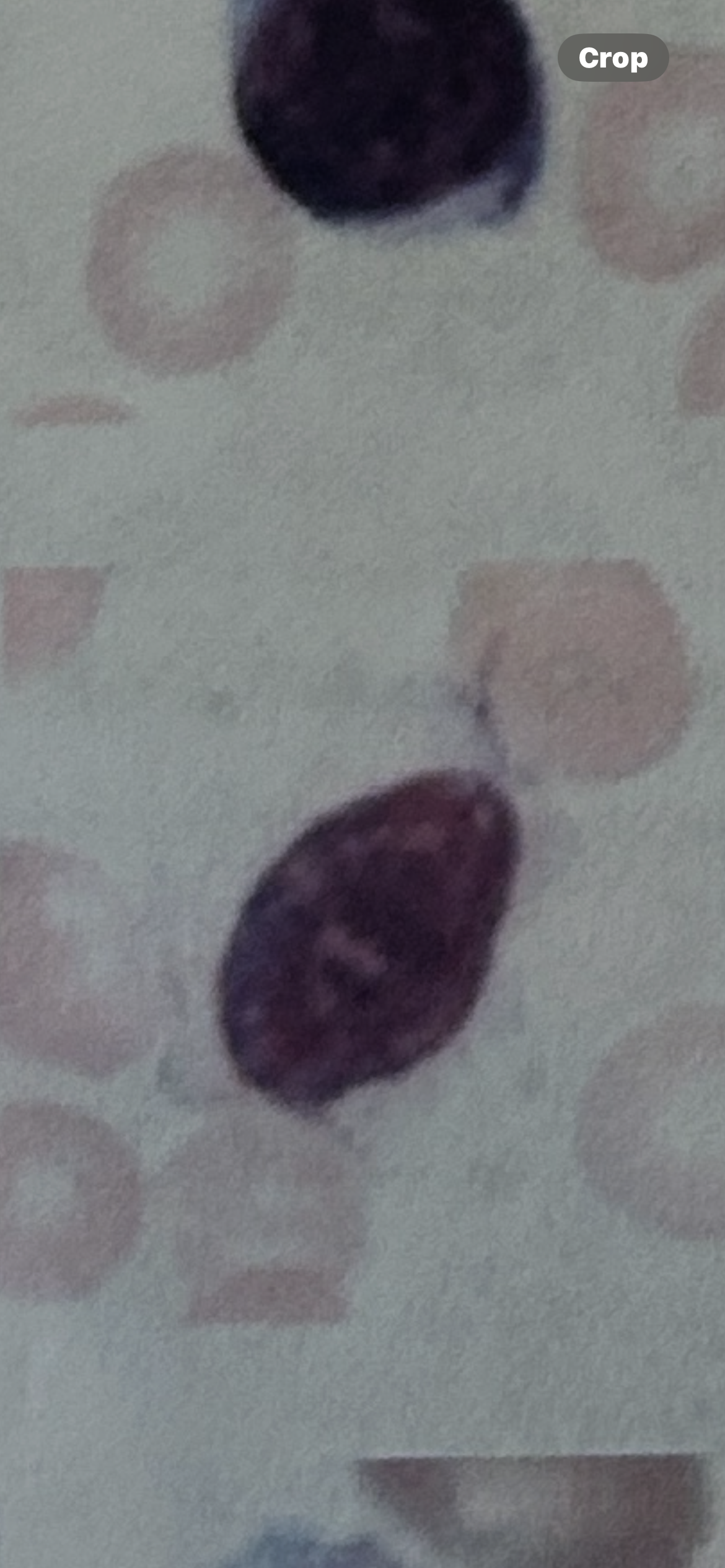 <p>WBC</p>