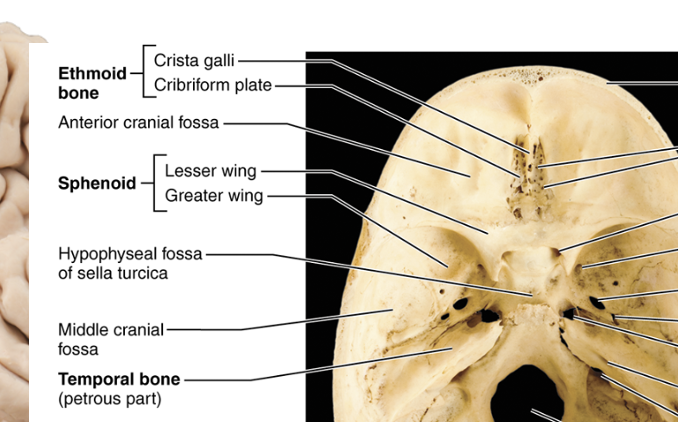 <p>cribriform plate</p>