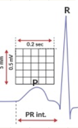 <ul><li><p>5 mini boxes or less → Between 0.10-0.20</p></li></ul><p></p>