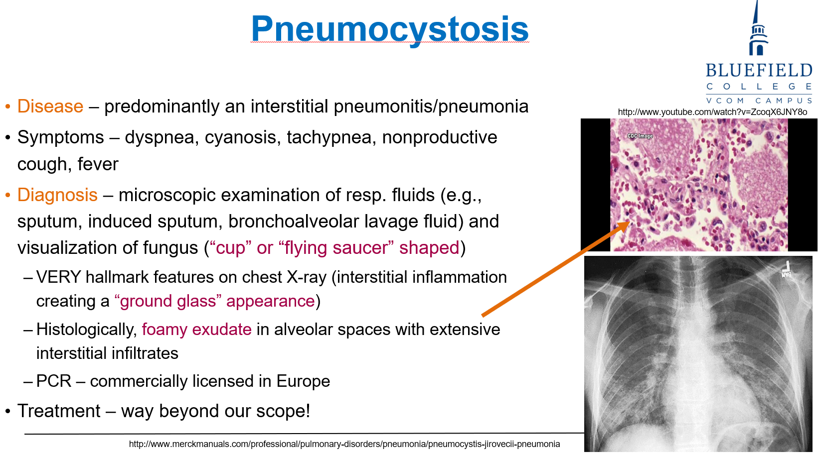 <p>C. Cup- or flying saucer-shaped cysts<br></p><p><em>Pneumocystis</em> appears as <strong>cup-shaped organisms</strong> on <strong>silver stain</strong>.</p>
