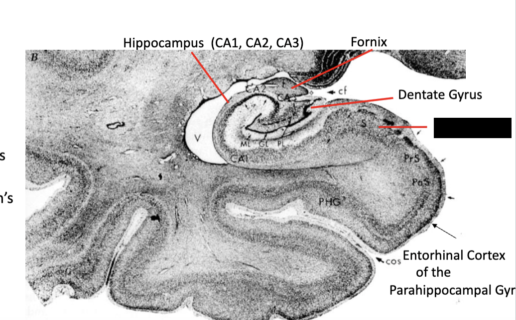 <p><strong>limbic system</strong></p><ul><li><p>what structure is this?</p></li></ul><p></p>