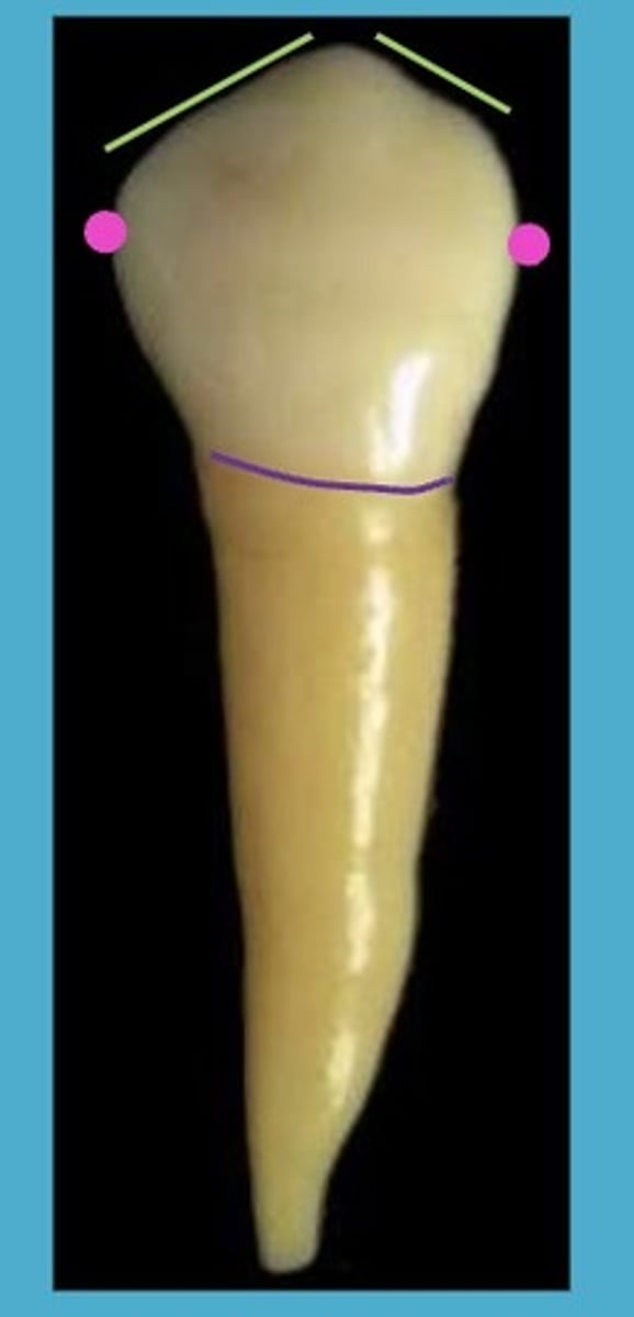 <p>M contact is located more cervically than the D contact</p>