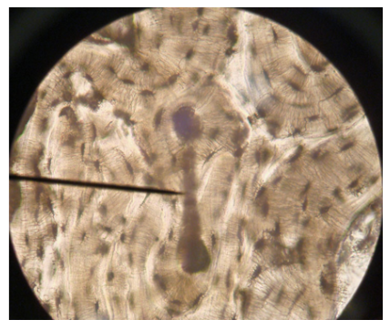 <p><span>Name the structure at the end of the pointer</span></p>