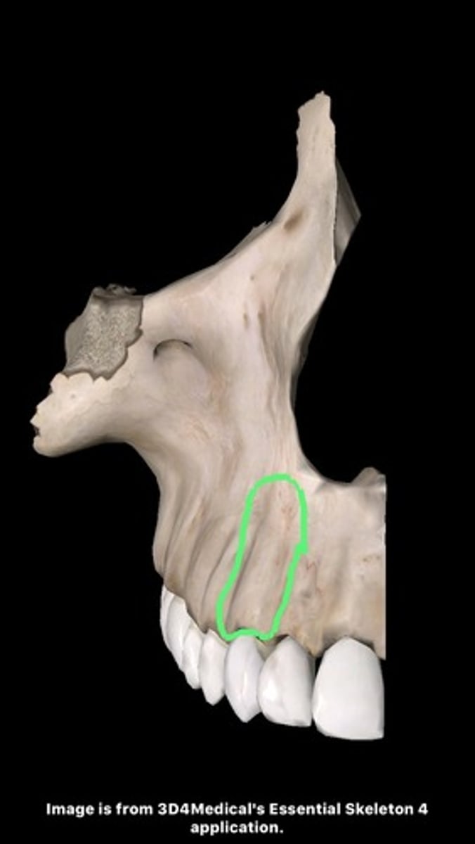 <p>bony eminence over the maxillary canine root on the facial surface of the maxilla</p>