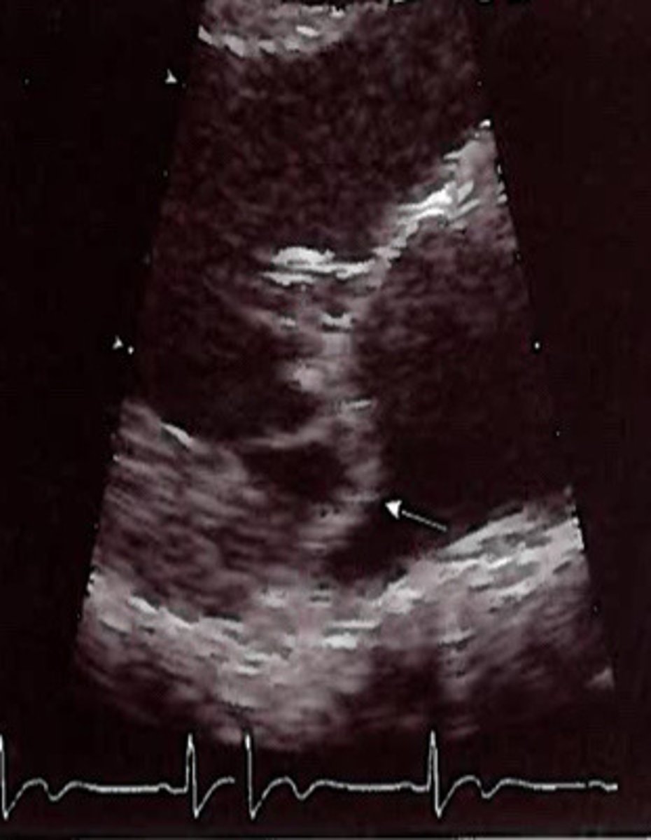 <p>What is represented by this image</p>