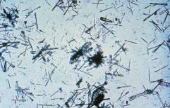<ul><li><p>seen in patients with high dose and dehydrated</p></li><li><p>Shape: needles and bundles</p></li><li><p>increased with refrigeration</p></li></ul><p></p>