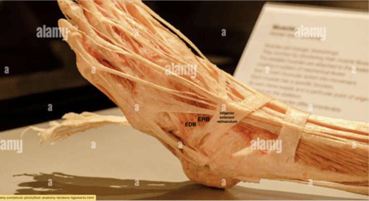 <p>Origin: extensor hallucis brevis</p>