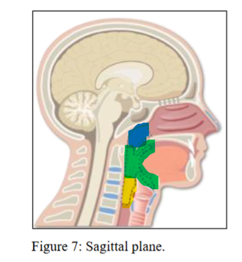 <p>label green (and its 4 boundaries)</p>