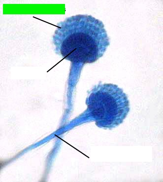 <p>What is the green arrow pointing to?</p>