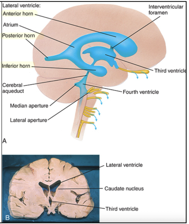 <p>Septum pellucidum which covers the medial half of each ventricle. </p>