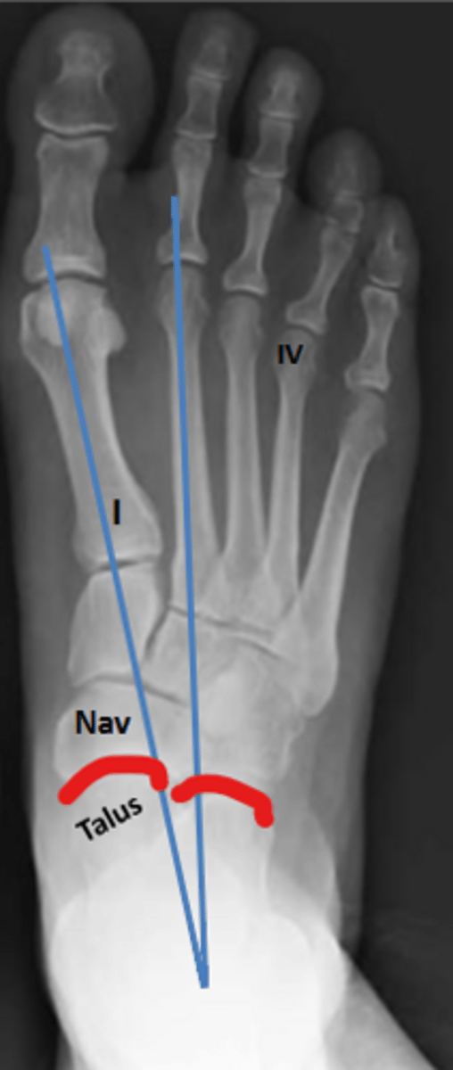 <p>What joint is this?</p>