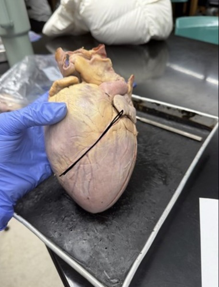 <p>On ventral side</p>