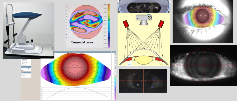 <p>Flashes vertical line patterns on the fluorescein-dyed tear film to map corneal &amp; scleral topography</p>