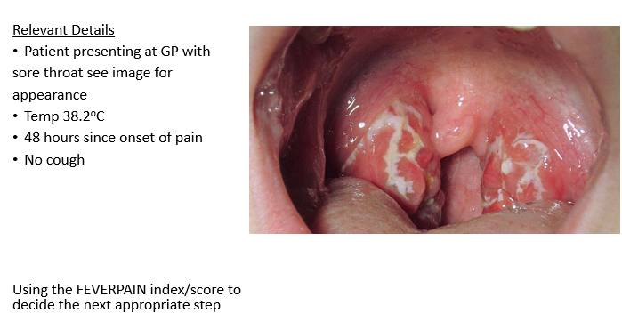 <p>The patient's symptoms suggest a possible upper respiratory infection. Further evaluation, including examination and possibly a rapid strep test, may be considered to determine if the sore throat is due to a bacterial infection, such as streptococcal pharyngitis. If bacterial, antibiotics may be prescribed. However, viral causes, such as the common cold or influenza, should also be considered, and symptomatic treatment may be recommended.</p><p>Most likely tonsilitis - bacterial infection - deviated uvula </p>