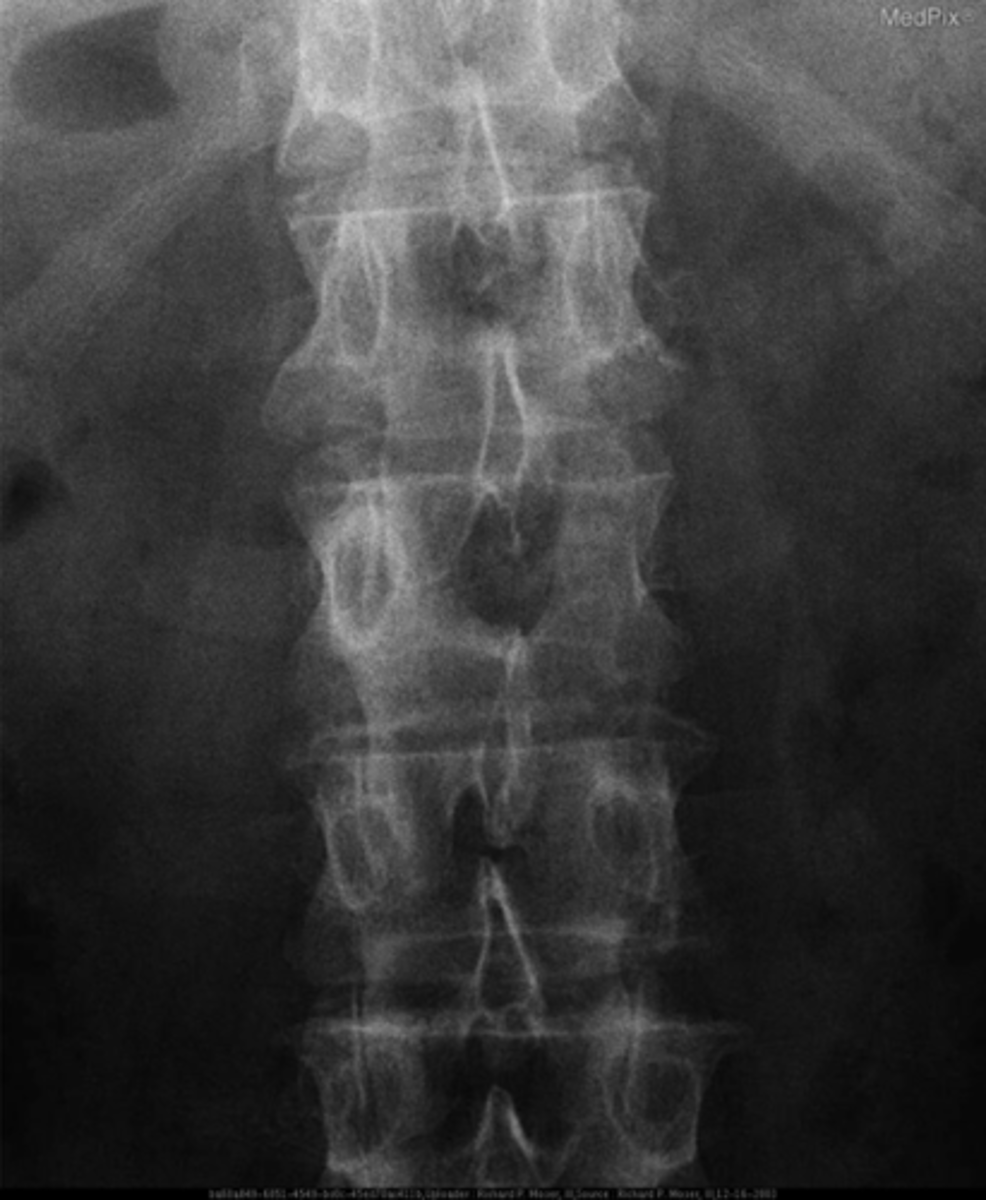 <p>How could you differentiate this anomaly from an aggressive lesion?</p>