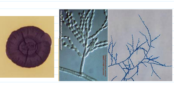 <ul><li><p><span>Slow growing</span></p><ul><li><p><span>Mature in 18 days</span></p></li></ul></li><li><p><span>Velvety, dull dark surface</span></p></li><li><p><span>Reverse is black</span></p></li><li><p><span>Cladosporium type sporulation</span></p></li><li><p><span>somewhat poiny conidia</span></p></li></ul><p></p>