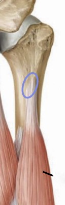 <p>lateral surface of humerus </p>
