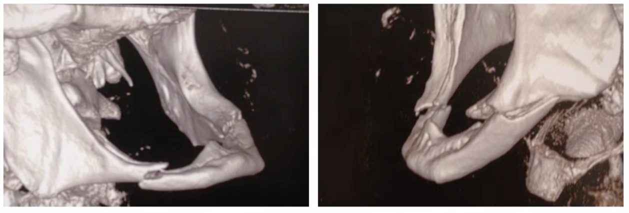 <p><span style="color: blue;"><strong>Comment appelle-t-on cette fracture ?</strong></span></p>