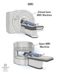 <p>Magnetic Resonance Imaging (MRI)</p>