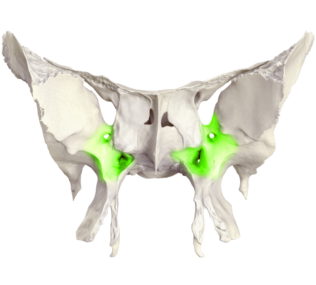 <p>felső állcsonti felszín</p>