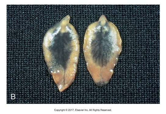 <ul><li><p>Flukes are endoparasites of domestic and wild animals and sometimes humans​</p></li><li><p>Most are flat and broad, although a few are thicker and fleshier like Fascioloides magna​</p></li><li><p>Schistosomas can be long thin and wormlike, more resembling nematodes</p></li></ul><p></p>