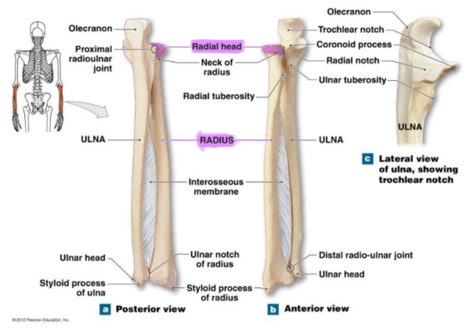 <p>disc-shaped proximal end that articulates w/ the capitulum of humerus & radial notch of ulna; allows radius to rotate around the ulna</p>