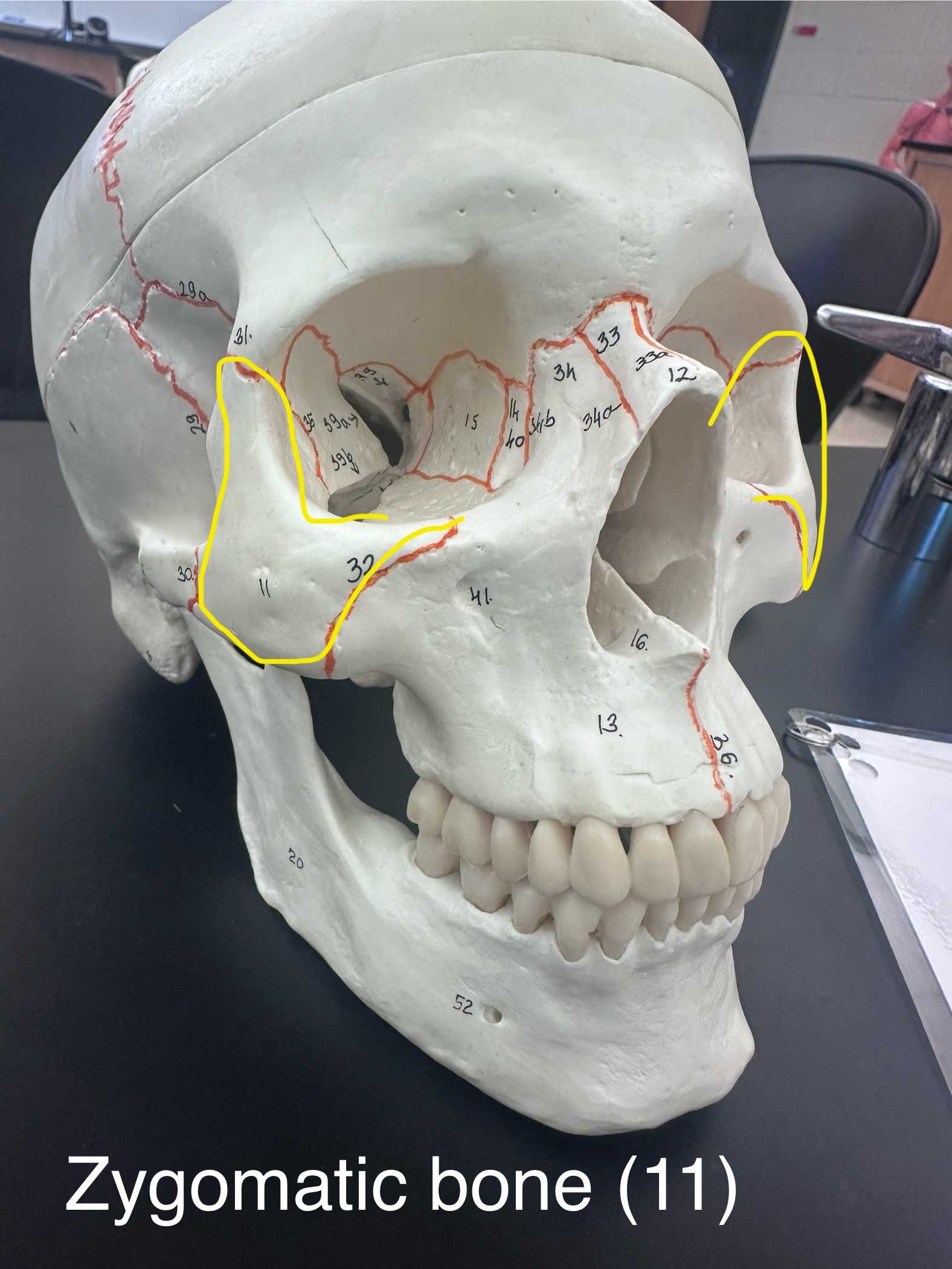 <p>Zygomatic Bone</p>