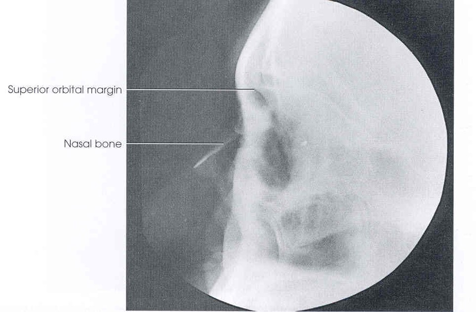 <p>xray</p>