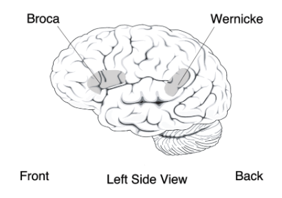 <p><strong>Aphasia</strong> is a language disorder caused by brain damage that affects a person's ability to communicate. It can impact speech, comprehension, reading, or writing.</p><p><strong>Two Types of Aphasia:</strong></p><ol><li><p><strong>Broca’s Aphasia</strong>:</p><ul><li><p>Caused by damage to <strong>Broca’s area</strong> in the <strong>lower left frontal lobe</strong>.</p></li><li><p>Results in <strong>difficulty speaking</strong>, with slow, effortful speech, but comprehension remains relatively intact.</p><p></p></li></ul></li><li><p><strong>Wernicke’s Aphasia</strong>:</p><ul><li><p>Caused by damage to <strong>Wernicke’s area</strong> in the <strong>posterior portion of the left hemisphere</strong>.</p></li><li><p>Leads to <strong>difficulty understanding</strong> language, with fluent but often nonsensical speech.</p></li></ul></li></ol><p></p>