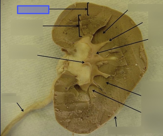 <p>What portion of the kidney is indicated by the blue box</p>