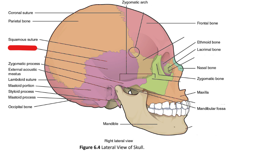 term image