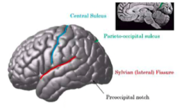<p>separates occipital and temporal lobe</p>