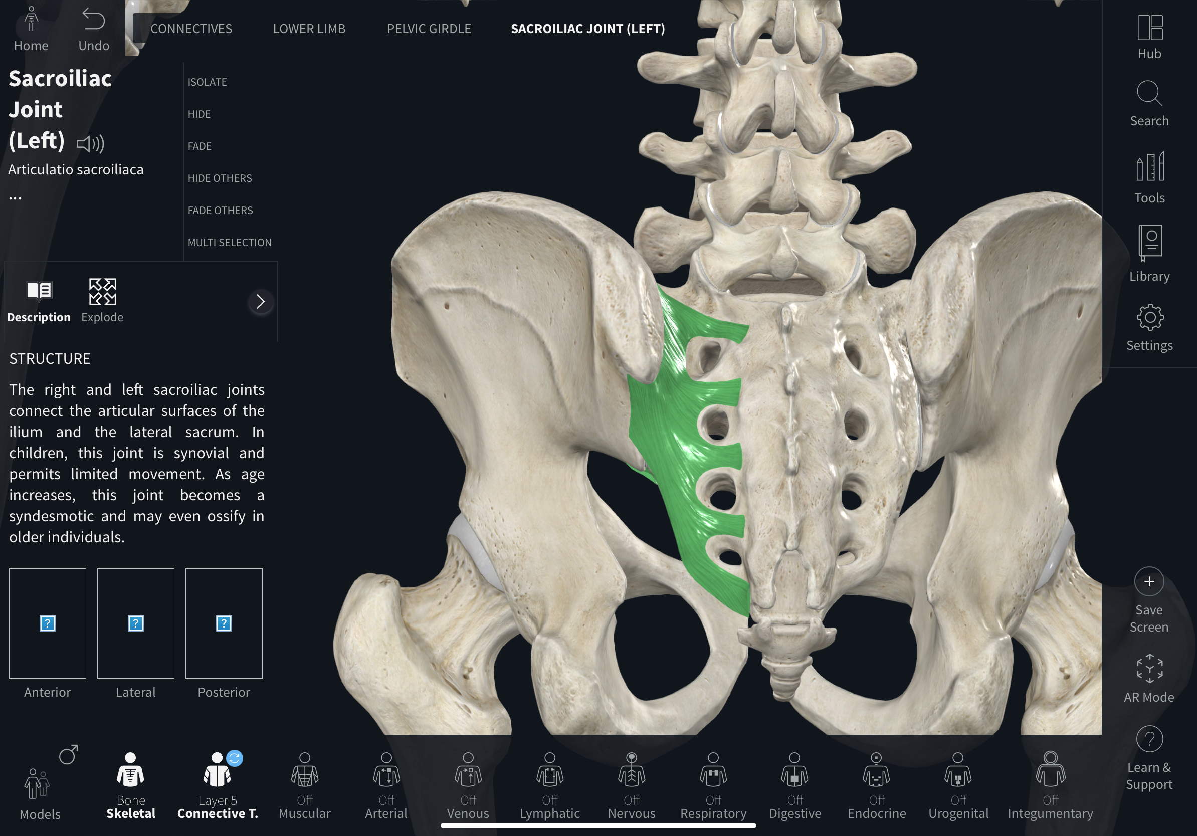 <p>Joint between the sacrum and ilium; composed of a synovial anterior part and a fibrous posterior part; typically immovable but allows weight transfer to the hip via ligaments.</p>