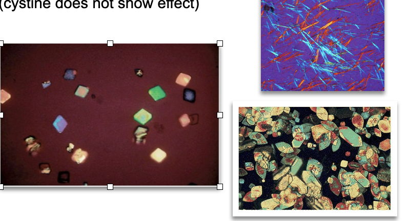 <ul><li><p class=""><strong>Highly birefringent</strong> under polarized light</p></li><li><p class="">Exhibits colorful, refractive patterns</p></li><li><p class="">Helps differentiate from cystine crystals, which do <strong>not</strong> show birefringence</p><p class=""></p></li></ul><p></p>